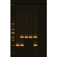 Human Dna Typing Using Pcr