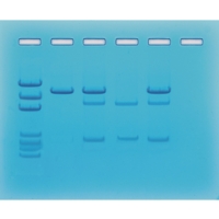 Cancer Gene Detection Cancer Gene Detection