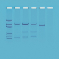 Dna Paternity Testing Simulation Dna Paternity Testing Simulation