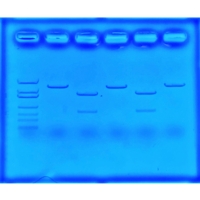 Using CRISPR to Treat Cystic Fibrosis