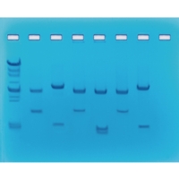 Dna Fingerprinting Using Restricted Enz Dna Fingerprinting Using Restricted Enz