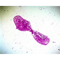 Escherichia Coli (b.3-19) Escherichia Coli (b.3-19)