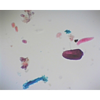 Mixed Protozoa Mixed Protozoa