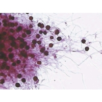 Rhizopus Stolonifer With Sporangia