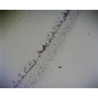 Penicillium Section With Hyphae And