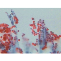 Aspergillus Sp. (eurotium) Section On Aspergillus Sp. (eurotium) Section On