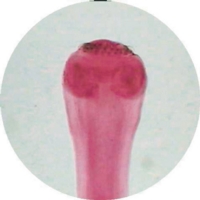 Taenia Pisiformis Cysticercus W.m. Taenia Pisiformis Cysticercus W.m.