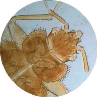 Cimex Lectularis W.m. (z.7-840 )