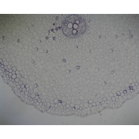 Ranunculus Ts Mature Root With Metaxylem