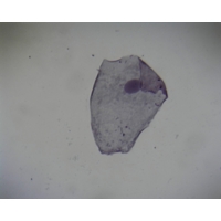 Squamous Epithelium From Human Mouth Squamous Epithelium From Human Mouth