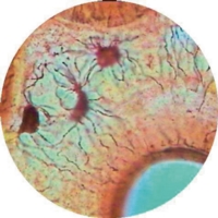 Pseudostratified Ciliated Columnar Epith
