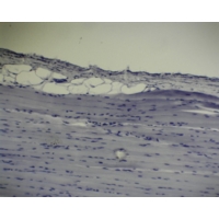 Striated Muscle L.s.