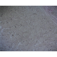 Non-striated Smooth Muscle Non-striated Smooth Muscle