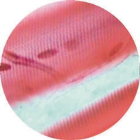 Cardiac Muscle Ls For Intercalated Discs Cardiac Muscle Ls For Intercalated Discs