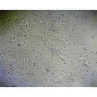 Nerve Cells Isolated Smear Of Spinal Nerve Cells Isolated Smear Of Spinal