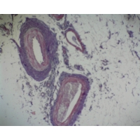 Human Artery And Vein Plastic Embedded Human Artery And Vein Plastic Embedded