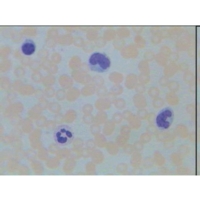 Liver Injected Section (h.5-30 ) Liver Injected Section (h.5-30 )