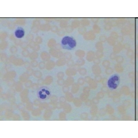 Lung Injected Thick Section (h.5-38) Lung Injected Thick Section (h.5-38)