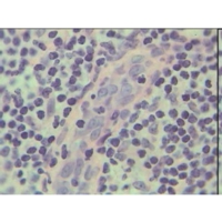 Lymph Node T.s. Cortex And Medulla