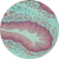 Stomach To Show Mucus Cells Parietal