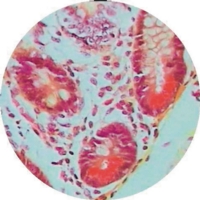 Colon Large Intestine Ts Colon Large Intestine Ts