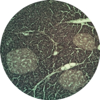 Pancreas For Islet Of Langerhans And Pancreas For Islet Of Langerhans And