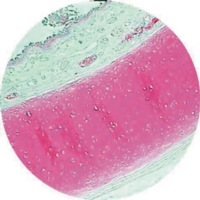 Bronchus T.s Plastic Embedded Bronchus T.s Plastic Embedded
