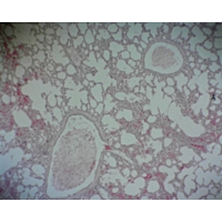 Lung For Elastic Fibres And Collagen