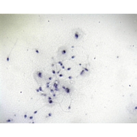 Human Spermatozoa Smear (h.10 -8) Human Spermatozoa Smear (h.10 -8)