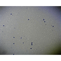 Blood Smear Stained To Show Red Cells Blood Smear Stained To Show Red Cells