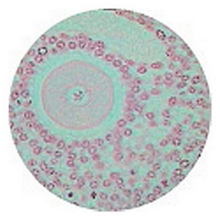 Kidney Vs(h10-102) Kidney Vs(h10-102)