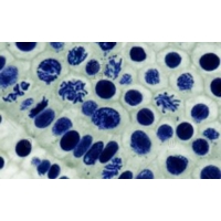 Mitosis And Meiosis Set 2 Mitosis And Meiosis Set 2