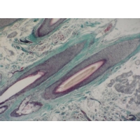 Human Scalp And Hair Microscope Slide Human Scalp And Hair Microscope Slide