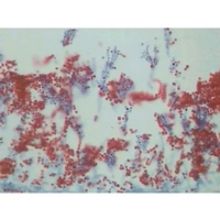 Basic Mycology Slide Set Basic Mycology Slide Set