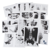 Human X-ray Print Set A4 Human X-ray Print Set A4