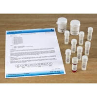 Bacterial Amylase Project Pack Bacterial Amylase Project Pack