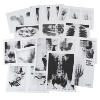 Human X-ray Print Set A3 Human X-ray Print Set A3